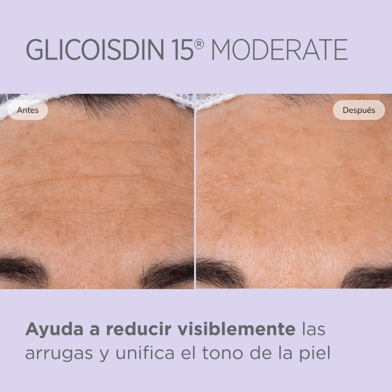 Isdinceutics Glicoisdin 15 Moderate 50g